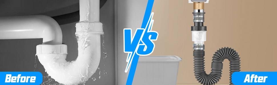 20 Stk Schlauchschellen Set